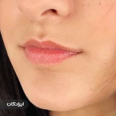 کلینیک زیبایی سوما