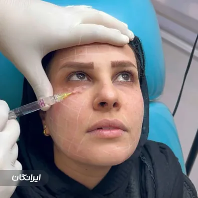 کلینیک زیبایی آلفا