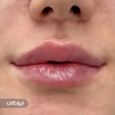 کلینیک زیبایی ویولت