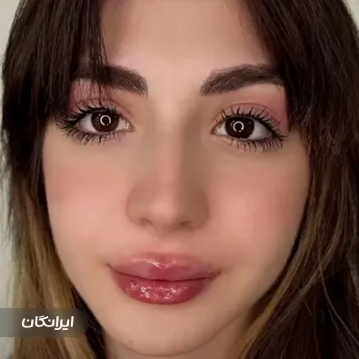 دکتر فرانک دیبایی