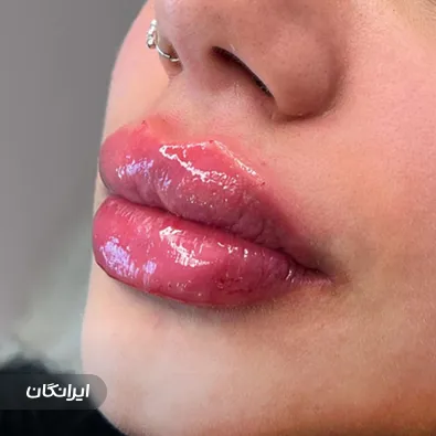 دکتر فرانک دیبایی