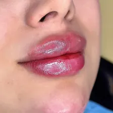 کلینیک زیبایی لاوین