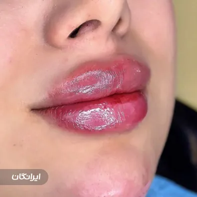 کلینیک زیبایی لاوین