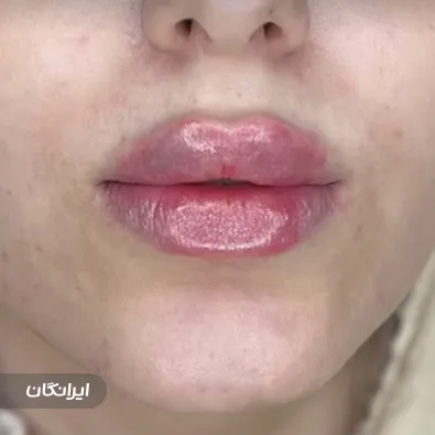 کلینیک زیبایی لاوین