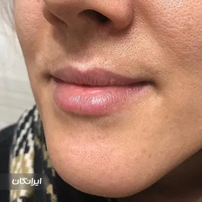 کلینیک زیبایی‌ مهریماه