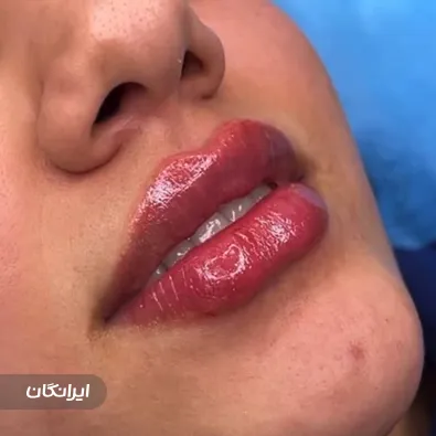 کلینیک زیبایی دکتر بهمن خزاعی