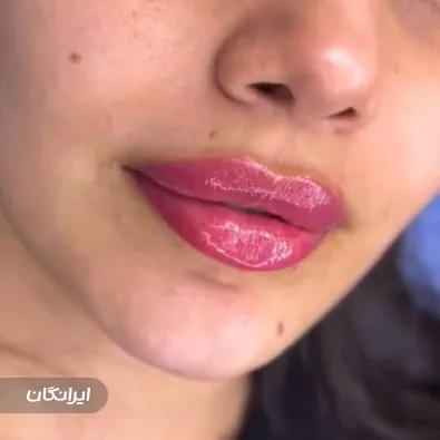 کلینیک زیبایی دکتر بهمن خزاعی