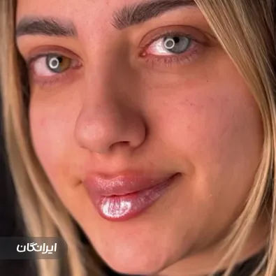 کلینیک زیبایی آنیل