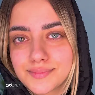 کلینیک زیبایی آنیل