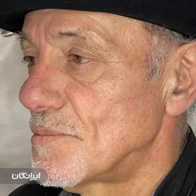 کلینیک زیبایی چهره نو