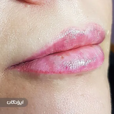 کلینیک زیبایی بوژنه