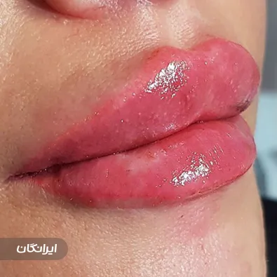 کلینیک زیبایی بوژنه