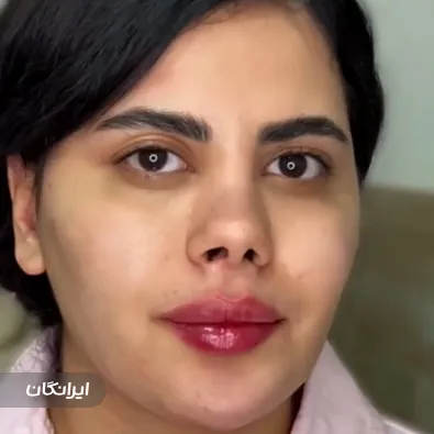 کلینیک زیبایی آریزون