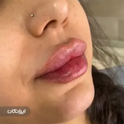 کلینیک زیبایی آریزون