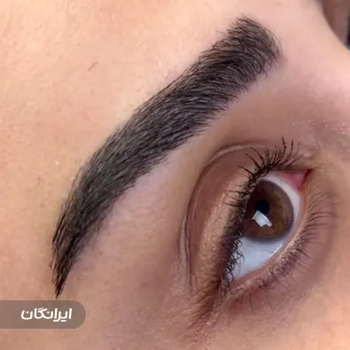 کلینیک کاشت لند