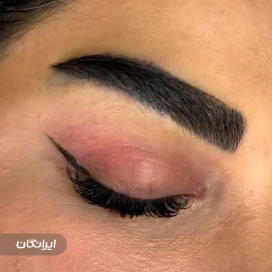 کلینیک کاشت لند