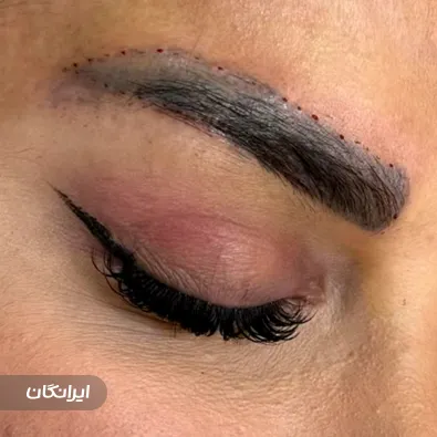 کلینیک کاشت لند