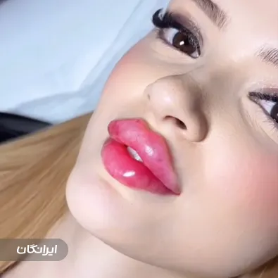 کلینیک زیبایی کیارش