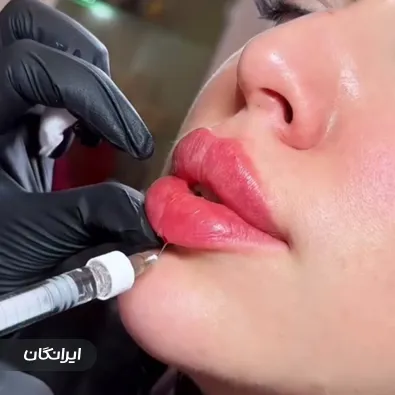 کلینیک زیبایی کیارش