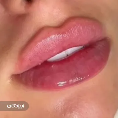 کلینیک زیبایی گلد