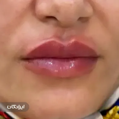 کلینیک زیبایی گلد