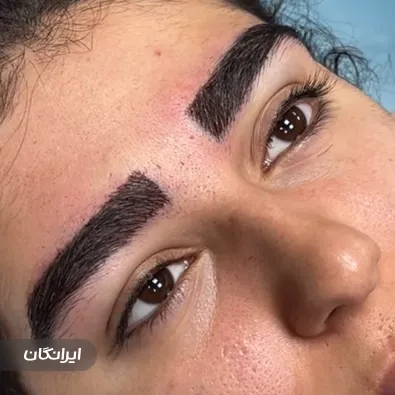 کلینیک کاشت مو دلی