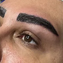 کلینیک کاشت مو دلی