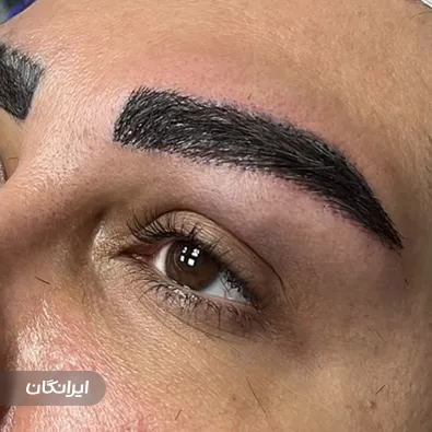 کلینیک کاشت مو دلی