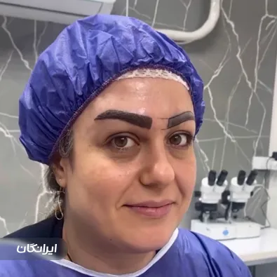 کلینیک کاشت مو دلی