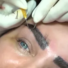 کلینیک کاشت مو آبان