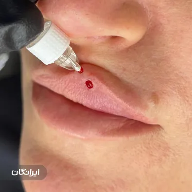 کلینیک زیبایی زیبارو