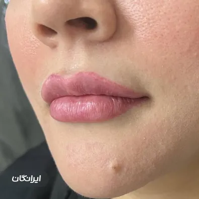 کلینیک زیبایی زیبارو