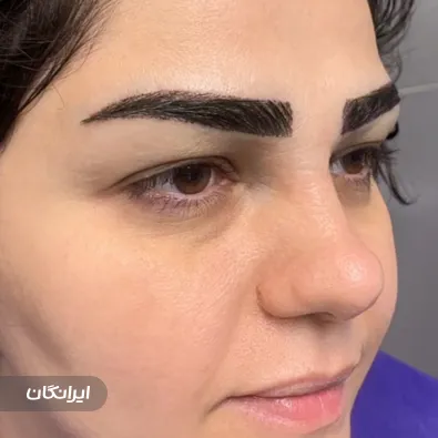 کلینیک کاشت مو اسمارت بیوتی