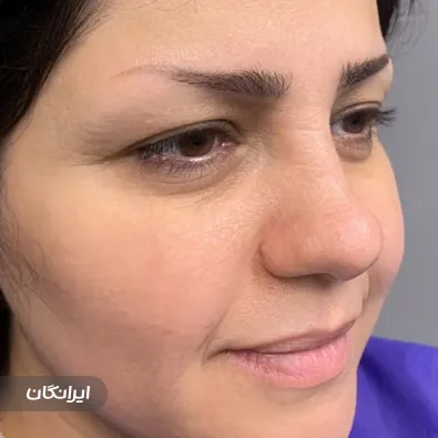 کلینیک کاشت مو اسمارت بیوتی