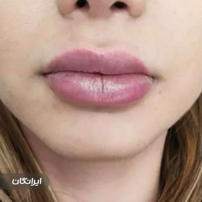 کلینیک زیبایی دکتر عباس احمدی شاهرخت