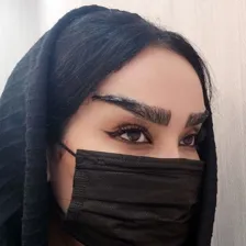 کلینیک کاشت مو رویان