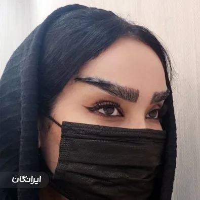 کلینیک کاشت مو رویان