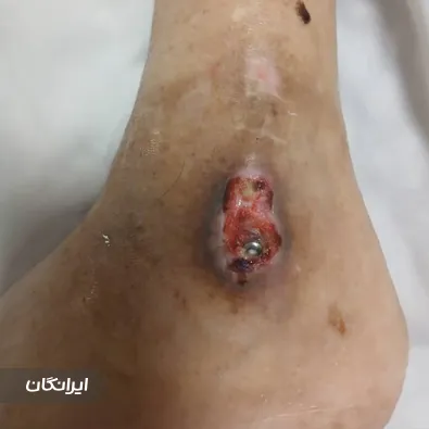 درمانگر زخم ندا شکوه