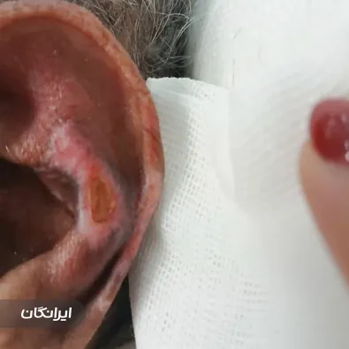 درمانگر زخم ندا شکوه