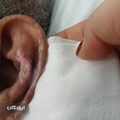 درمانگر زخم ندا شکوه