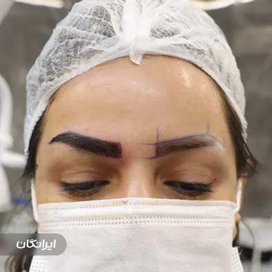 کلینیک زیبایی نیولایف