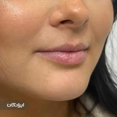 کلینیک زیبایی نکوئین