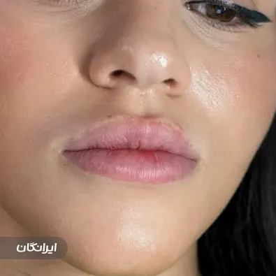 کلینیک زیبایی سمیرا بیوتی