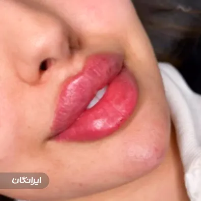 کلینیک زیبایی سمیرا بیوتی