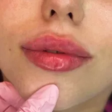 کلینیک زیبایی مهرآرا