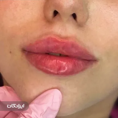 کلینیک زیبایی مهرآرا