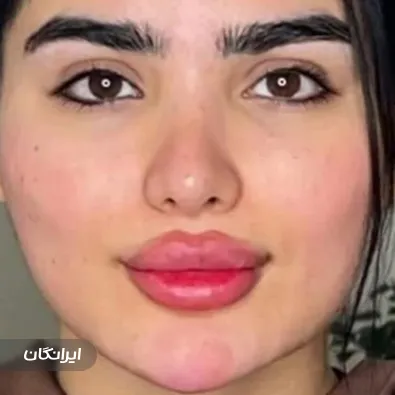 کلینیک زیبایی مهرآرا