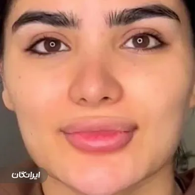 کلینیک زیبایی مهرآرا