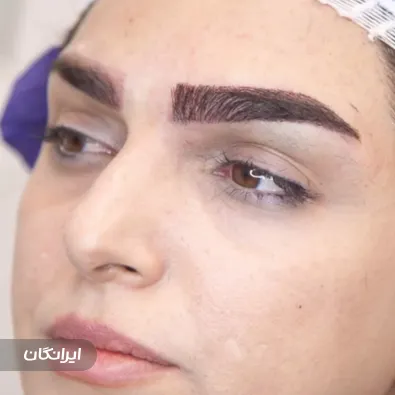 کلینیک زیبایی هالن