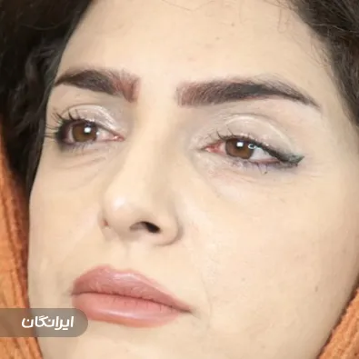 کلینیک زیبایی هالن